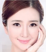 脸部抽脂要注意这四件事情