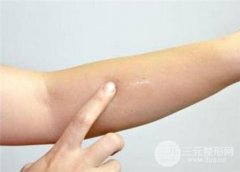 面部美容疤痕修复消除的的方法有哪些?