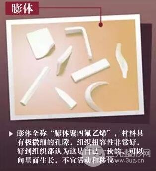 隆鼻喜欢用什么方法?教你选择适合自己的隆鼻方式