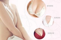 假体隆胸术的优点有哪些 果怎么样