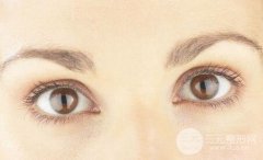 双眼皮没割好能马上修复吗？