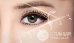 眼部整形切开双眼皮和埋线双眼皮哪个好?