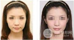 电波l皮项目的技术优势是什么?