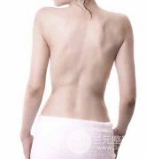 背部吸脂塑形果好不好?