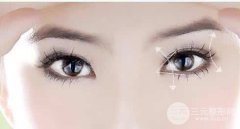 双眼皮手术有哪些优点?果好不好?