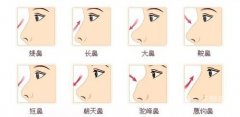 硅胶假体隆鼻失败怎么修复 硅胶假体隆鼻失败怎么修复