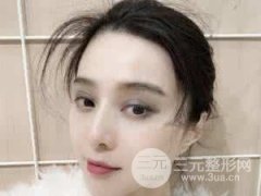 烫伤疤痕修复可以吗