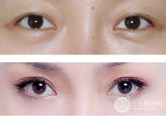 七大祛眼袋妙招