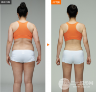 全身吸脂可以是一次性完成的吗？果可以管多久？