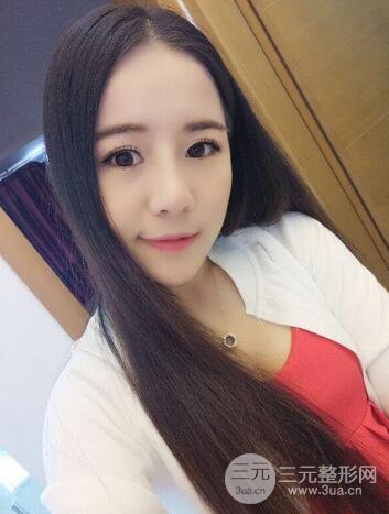 假体隆鼻恢复过程实例 前后果对比