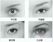 技巧！怎样选择适合自己的双眼皮手术？