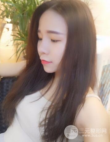 韩式生科隆鼻图片 深圳丽港丽格隆鼻整形归来