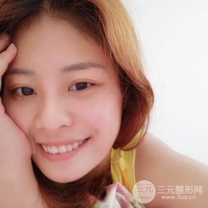 膨体隆鼻隆鼻整形前后对比 重庆军美鼻部整形