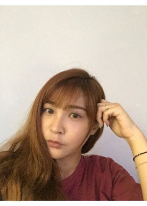 高强度聚焦超声手术前后过程以及真实案例分享——厦门思明安黛美林韵医生做的