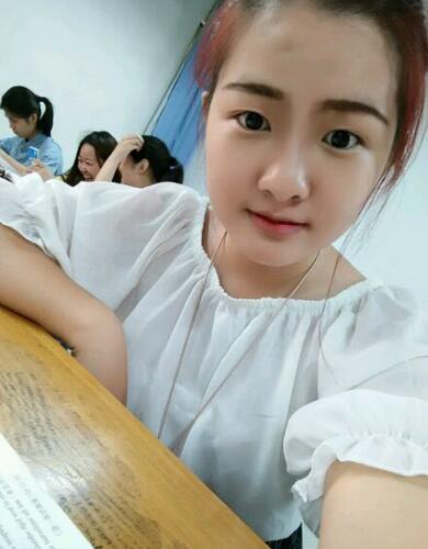 切开双眼皮开眼角恢复过程图 前后果对比