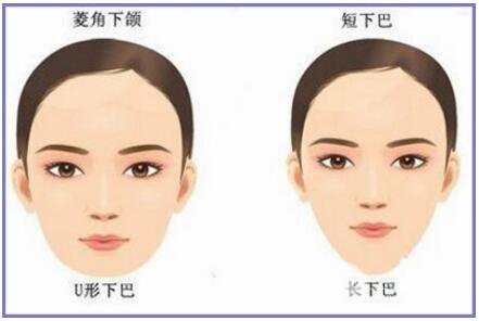 北京的医院磨骨怎么样,价格贵吗?影响价格的因素有哪些呢?