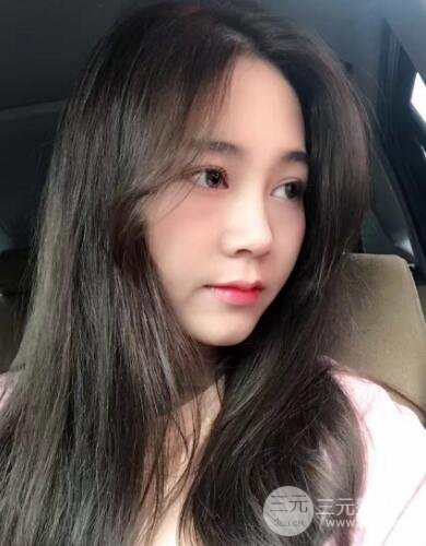 硅胶和耳软骨隆鼻果对比 重庆天艺美隆鼻整形案例