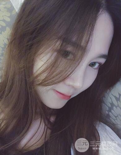 硅胶和耳软骨隆鼻果对比 重庆天艺美隆鼻整形案例