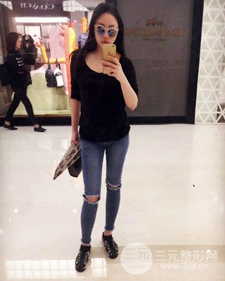 大腿吸脂前后对比照片，南昌永康王忠干真实案例分享