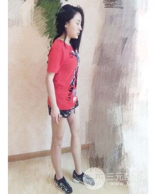 大腿吸脂前后对比照片，南昌永康王忠干真实案例分享