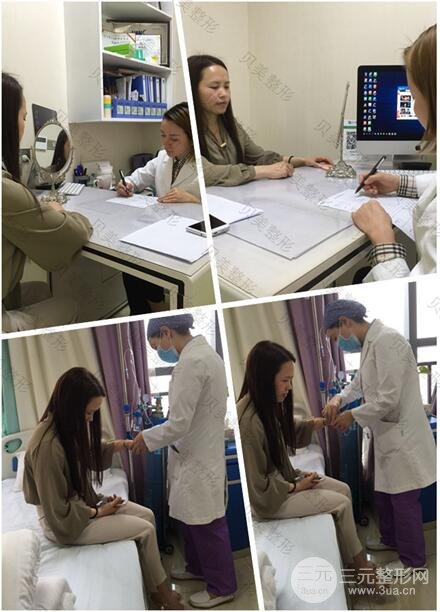 长沙贝美假体隆鼻+耳软骨垫鼻尖+鼻小柱延**果分享