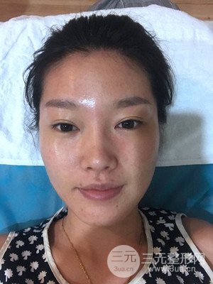 南昌永康整形打水光补水果图前后对比