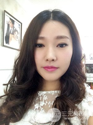 南昌永康整形打水光补水果图前后对比