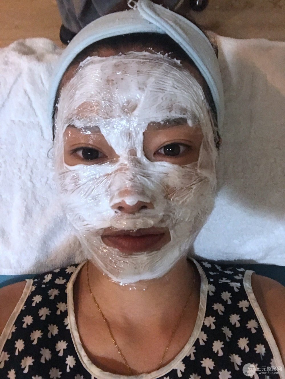 南昌永康整形打水光补水果图前后对比