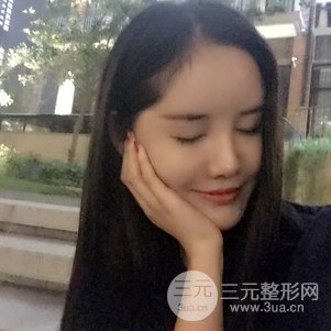 南京米尚恩陈天杰自体脂肪填充全脸 女神的养成记！