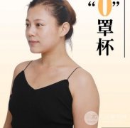 假体植入隆胸让我从0罩杯变身自信女人！