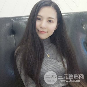 切开双眼皮前后对比图 美联致美切开双眼皮恢复过程