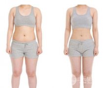 全身抽脂手术是怎样的?价格贵不贵?