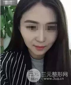 B****打几次定型