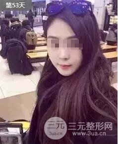 B****打几次定型