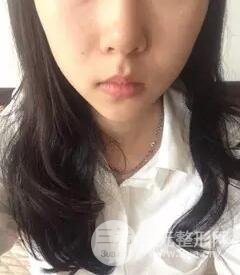 B****打几次定型