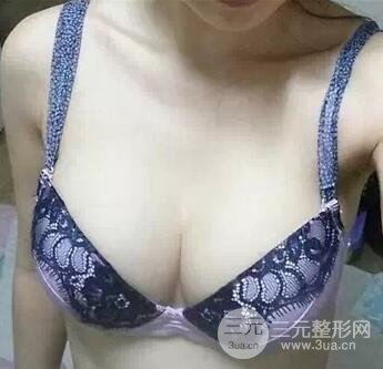 胸部大小不一样