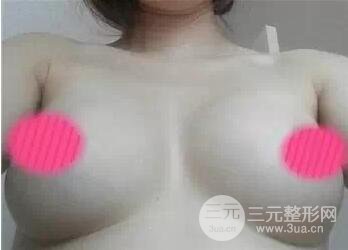 胸部大小不一样
