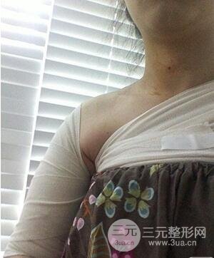 quanshenxizhiyaoduoshaoqian1