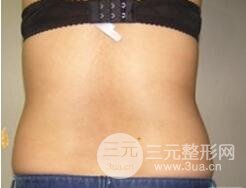 quanshenxizhiyaoduoshaoqian6