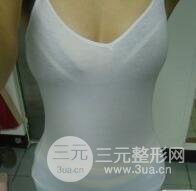 quanshenxizhiyaoduoshaoqian7