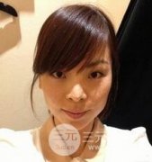 锯齿.线面b提升术前后对比图分享,让您返老还童不是梦! 锯齿.线面b提升术前后对比图分享,让您返老还童不是梦!