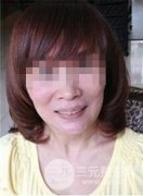 冰电波l皮好吗？做完之后都说我跟女儿神似姐妹！