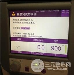 冰电波l皮好吗5