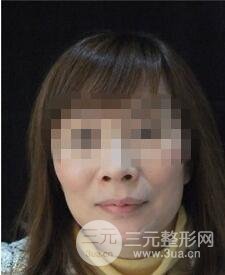 冰电波l皮好吗8