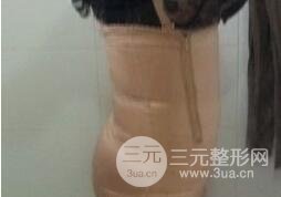 等离子光纤溶脂4