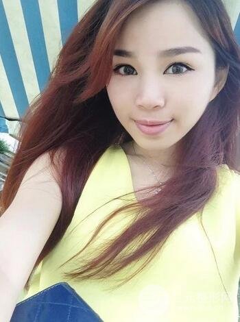 隆鼻整形多少钱？南京美梯隆鼻整形恢复日记及前后对比
