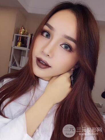 隆鼻整形多少钱？南京美梯隆鼻整形恢复日记及前后对比
