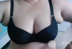 腋下副乳手术多少钱？附乳祛除手术案例7天果对比图