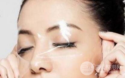 额部除皱术要多少钱 玻尿酸额部除皱果怎么样