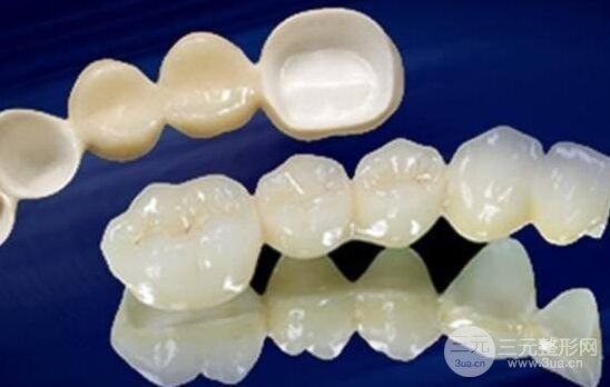 烤瓷牙的种类有哪些、烤瓷牙价格多少